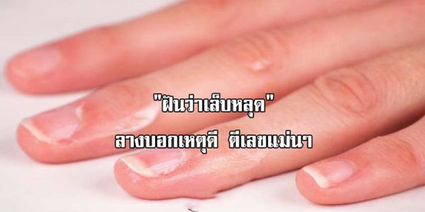 ฝันว่าเล็บหลุดนิ้วนาง