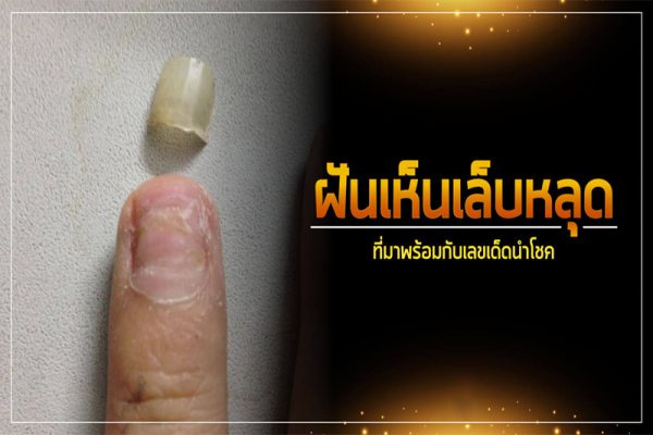 ฝันว่าเล็บฉีกนิ้วก้อย-"Dream of seeing nails fall off"
