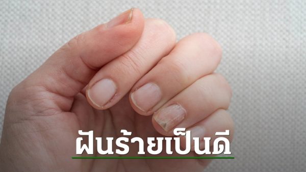 ฝันว่าเล็บฉีกนิ้วก้อย-"Nightmare is good"
