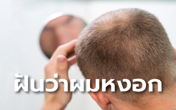 ฝันว่าผมขึ้นใหม่-"Dreamed that my hair grew back"
