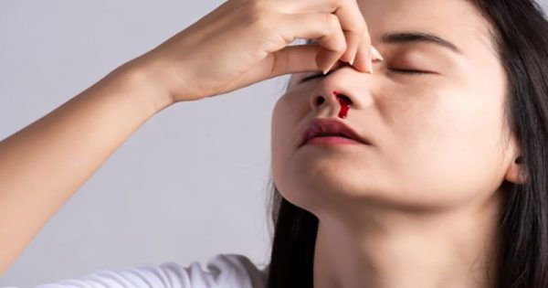 ฝันว่าเลือดออกจมูกไม่หยุด-"Dreamed that the nose would not stop bleeding."