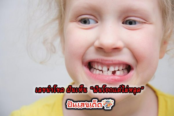 ฝันว่าฟันโยกข้างล่าง - "Dreaming about teeth falling out at the bottom"
