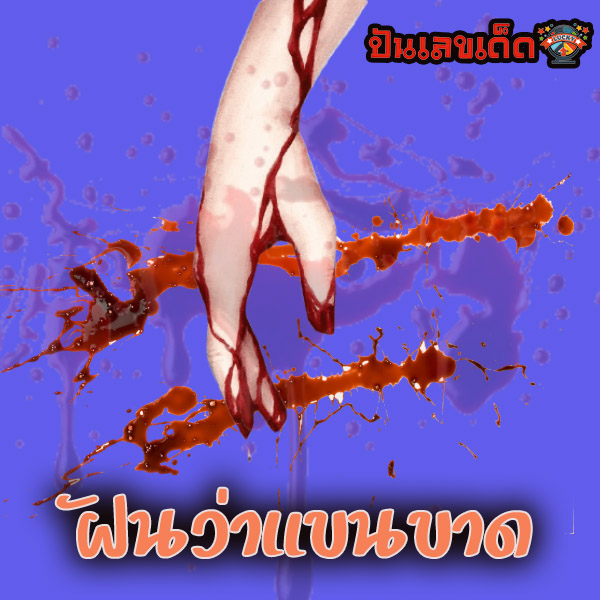 ฝันว่าแขนขาด -"Dreaming of losing an arm"