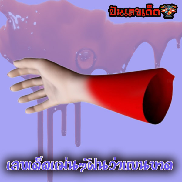 ฝันเห็นเพื่อนแขนขาด -"I dreamt that my friend had a broken arm."