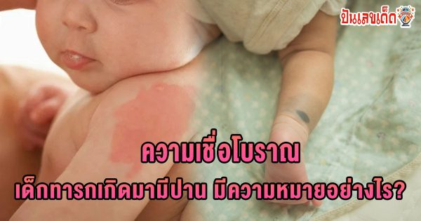 เด็กทารกที่เกิดมาแล้วมีปาน เป็นร่องรอยจากอดีตชาติ จริงหรือไม่ ? ความเชื่อโบราณของปานแต่ละตำแหน่ง เช็กฟรี !!