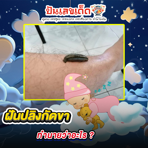 รูปภาพฝันปลิงกัดขาของ lekdedonline